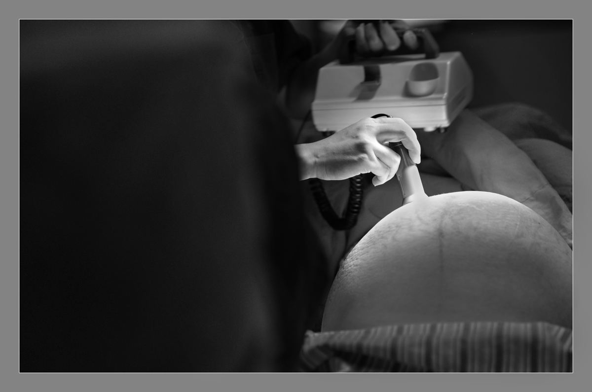 ���O(ji��n) �����g(sh��)ǰ���һ�αO(ji��n)�y̥�ġ���һ�ꇏ�̥�ăx�������Ҏ(gu��)�t����(qi��ng)�����Ĳ��������µ������Ȳ��������O�����ąȺ���